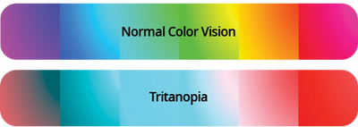 Tritan Type Color Blindness Test Result | EnChroma